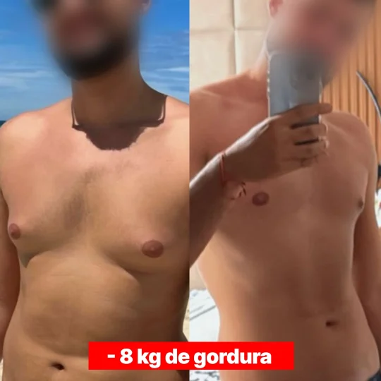 ANTES E DEPOIS 4